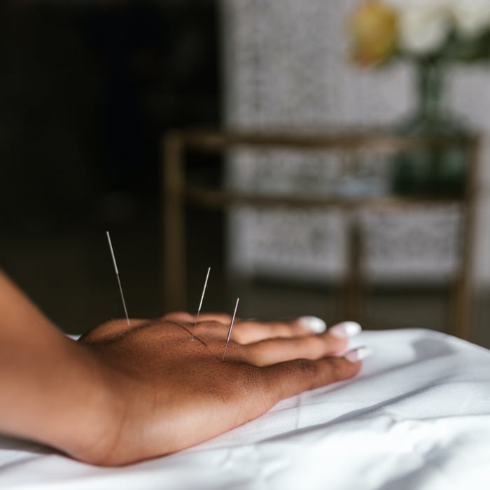 Acupuncture